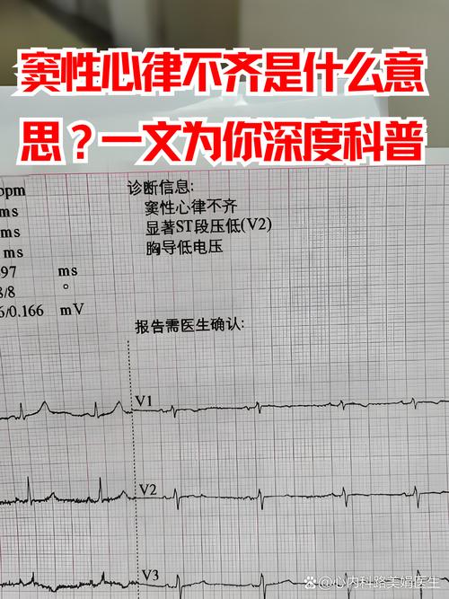 心率不齐免测理由