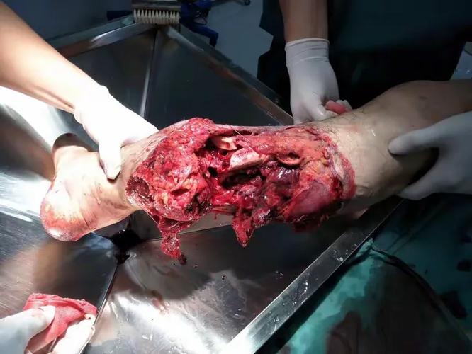 营口瑞林医院骨科怎么样