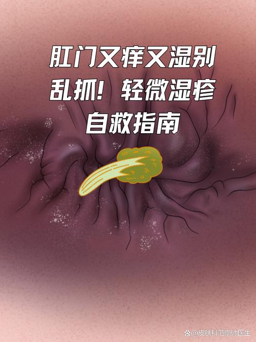 肛门外周围瘙痒是什么原因游戏截图