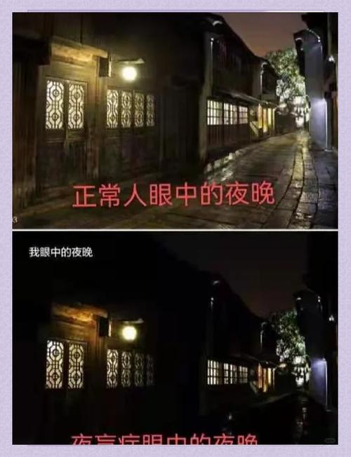 奶奶有夜盲症会遗传孙女吗