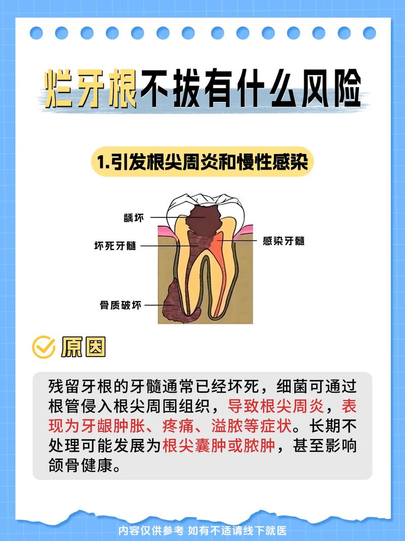 蛀牙松动不拔有危害吗