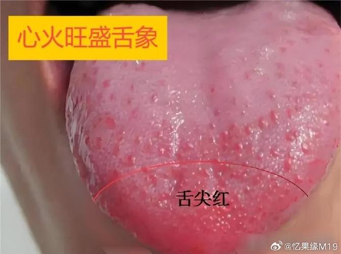 柑子和橙子哪个会上火