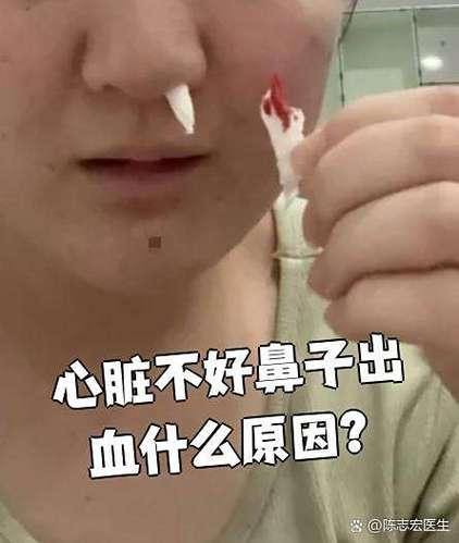 鼻子老流鼻血是什么原因