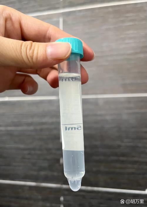 小便上面有一层白色漂浮物