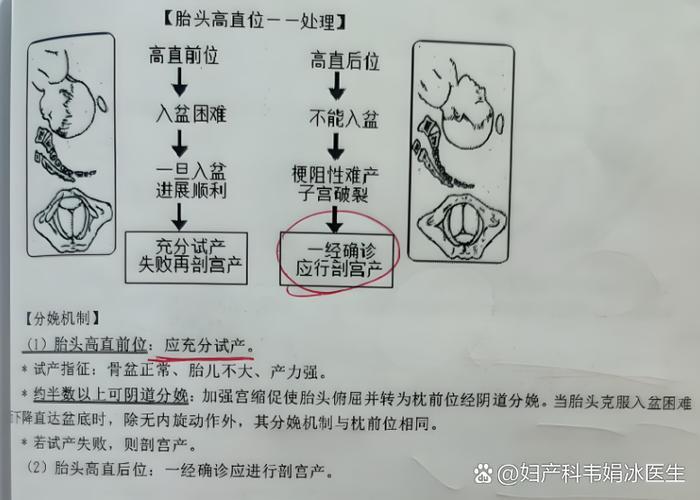 HC是胎儿的什么