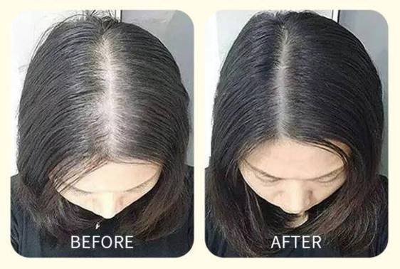 佳芙妮洗发水真的防脱吗