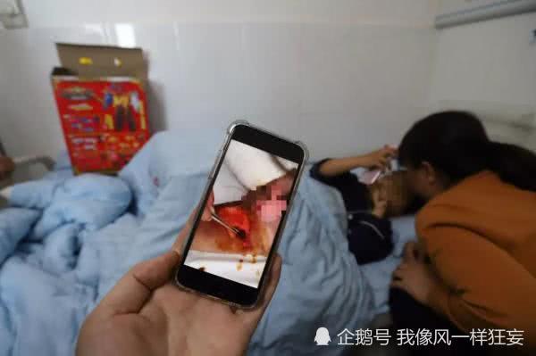 饭卡被热水烫了还能用吗