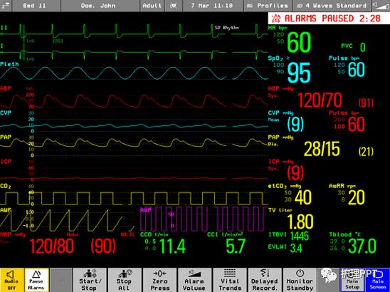 ecg spo2 resp及正常值
