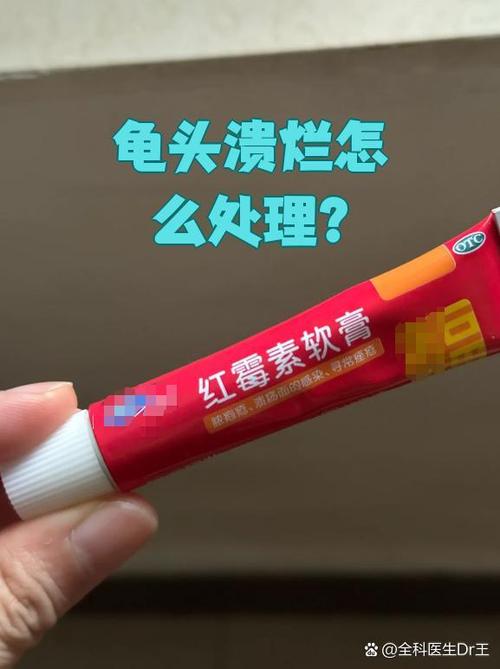 红霉素软膏会加速龟皮发炎吗