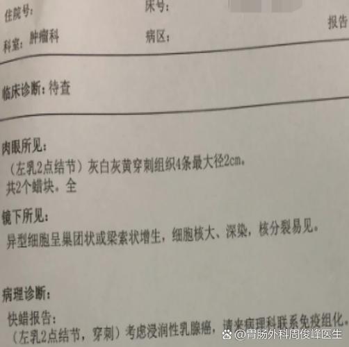 ib期是癌症几期