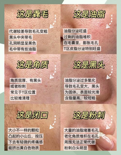 收缩毛孔的最好方法