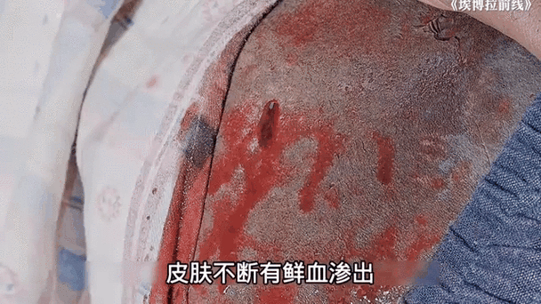 埃博拉病毒怕什么