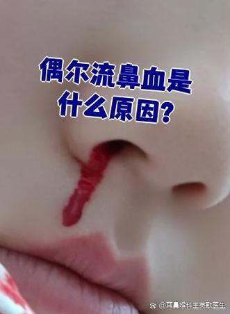 偶尔出鼻血什么原因导致的