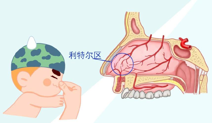 宝贝流鼻血会于eb病毒有关吗