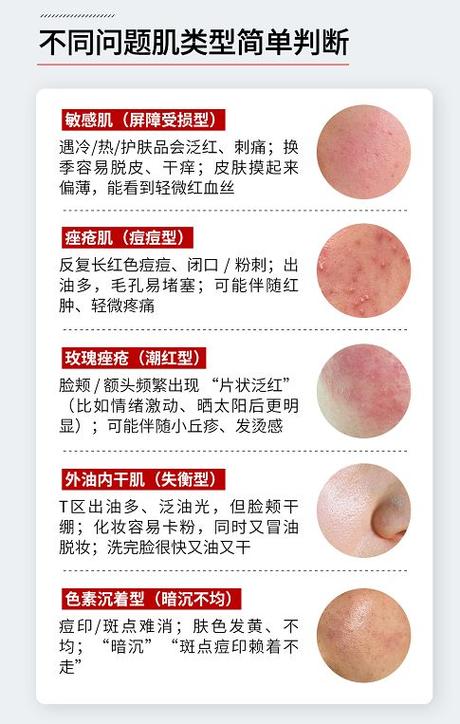 脸上长小红痘痘冒白点