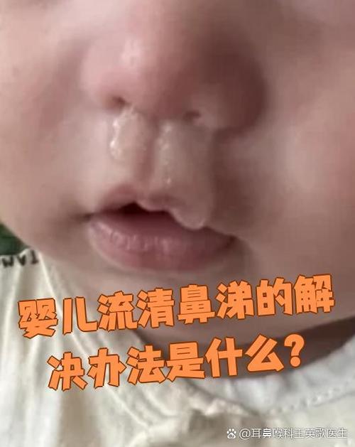 一招停止流清鼻涕