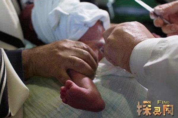 女性割礼指的是割哪里