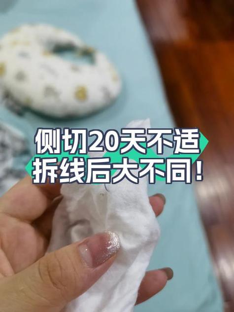 面部拆线后多久能洗脸