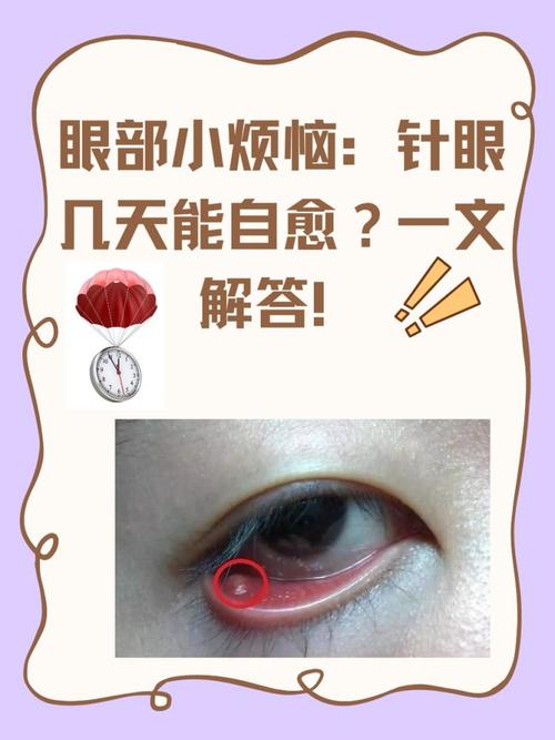 针眼摄像头哪里买图标