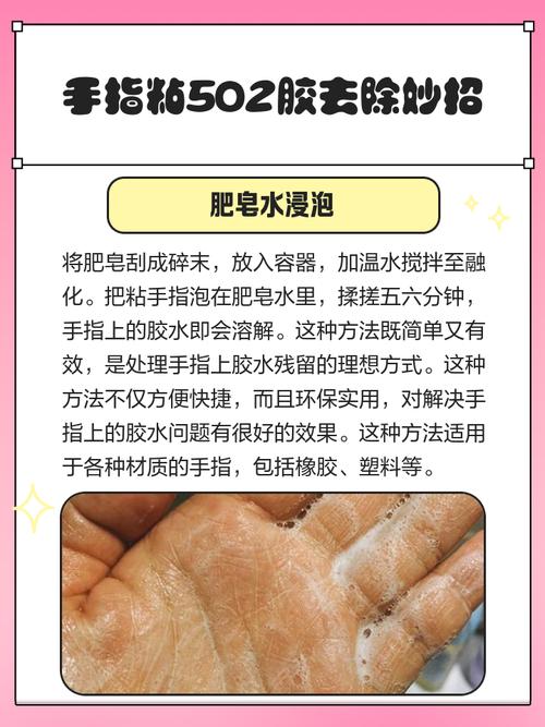 手指被502胶水粘掉了怎么快速去掉