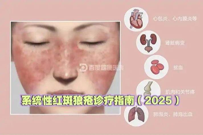 腿上有红色斑块