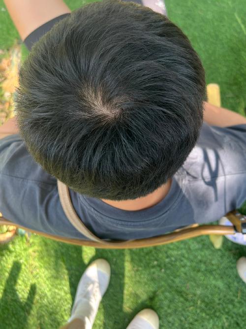 头顶上的旋怎么形成的