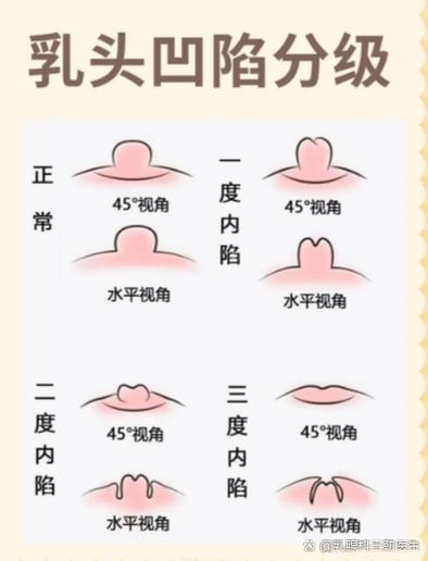“乳头”的别称