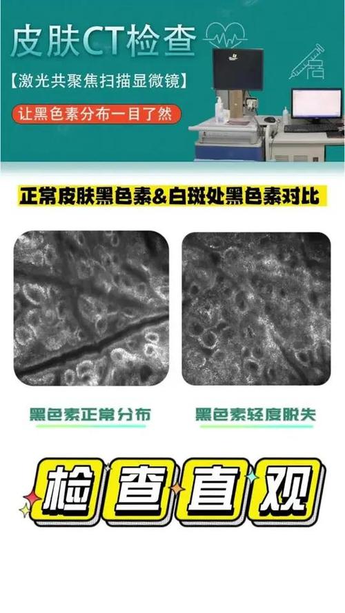换手机屏出现白斑是什么原因