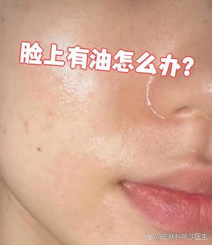 擦了护肤品脸上很油