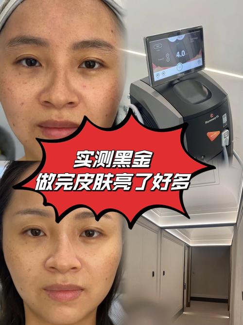 皮肤角质化图片