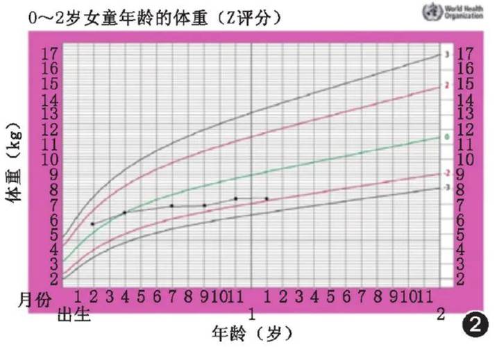 儿童生长发育z评分法截图