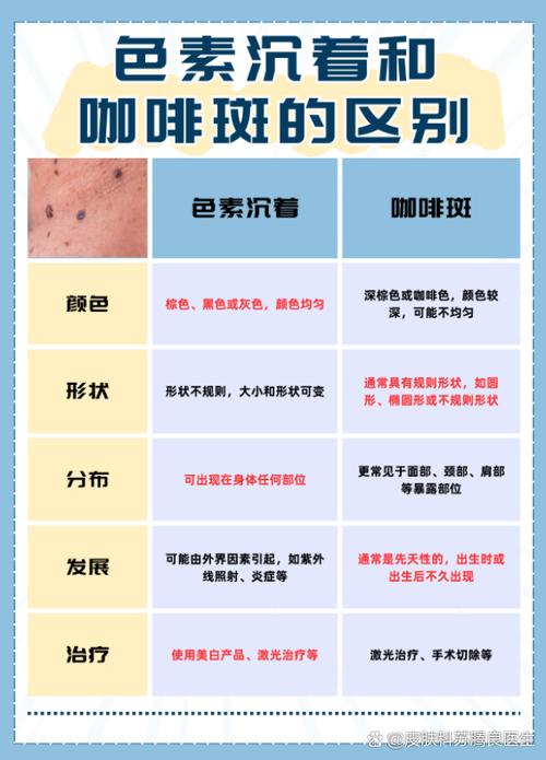 斑反黑是什么原因