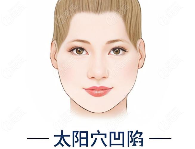 太阳凹陷是怎么造成的游戏截图