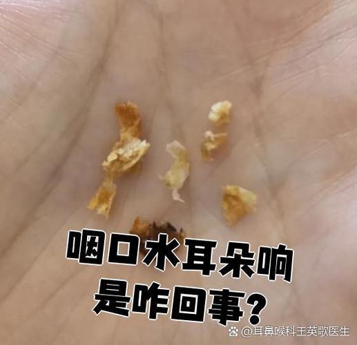 耳朵里呼隆呼隆的响是怎么回事
