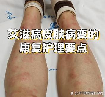 雨云病毒有什么危害
