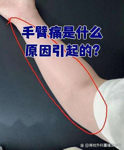 腋下酸痛至手臂酸痛