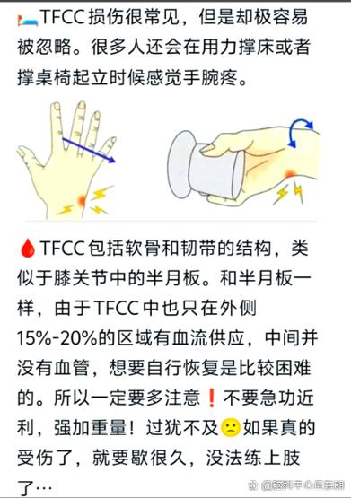 tfcc损伤算大病吗