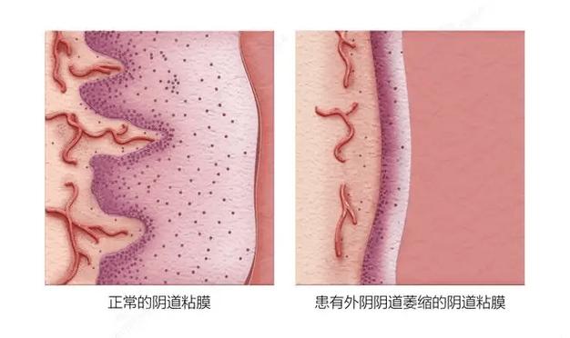 qq相册如何设置为私密截图