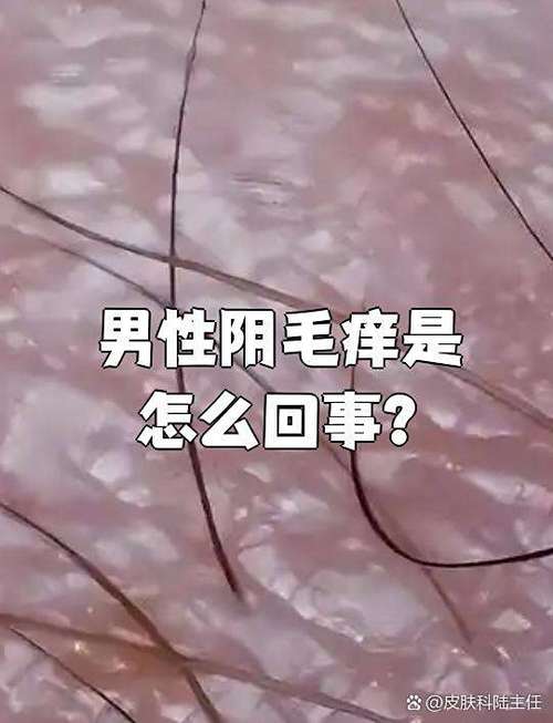 男士阴痒外面毛毛痒是什么原因