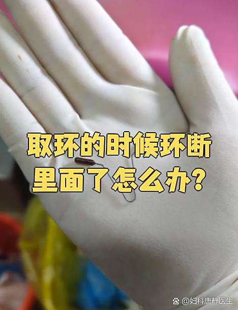 环自己掉出来了怎么办