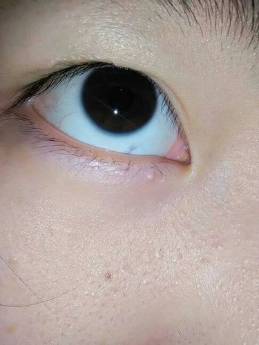 眼睛闪光灯有个白点怎么p掉
