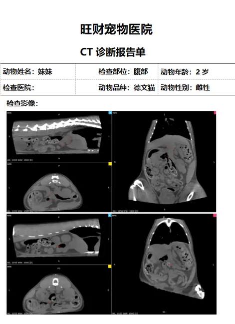 拍ct能带手机进去吗