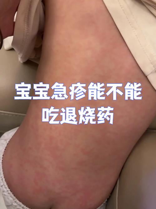 全身病毒感染症状缩略图