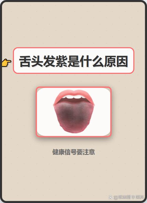 屏幕有紫色的点