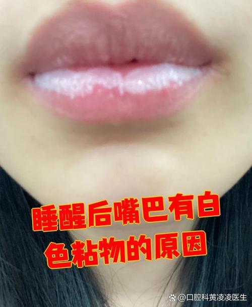 嘴巴老是黏黏糊糊的