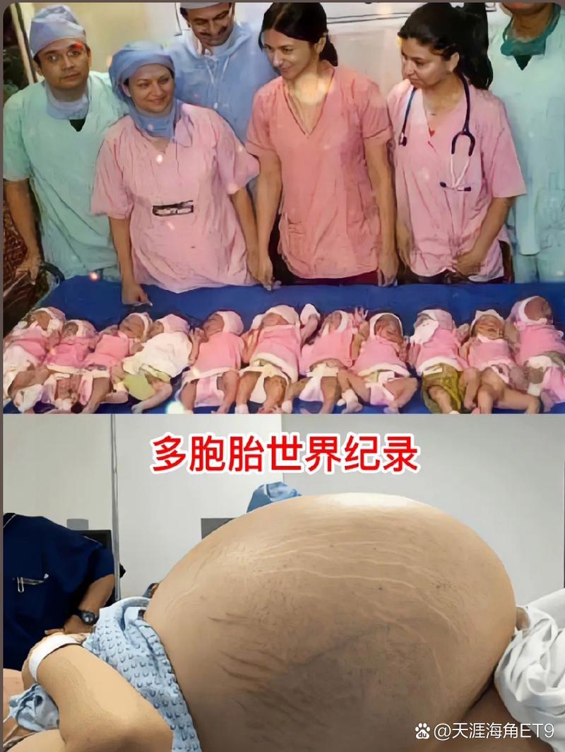 大肚多胎受孕不停生孩子