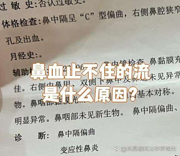 鼻血流的止不住是什么原因