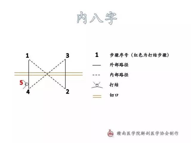 缝纫机针和针孔不对怎么办缩略图