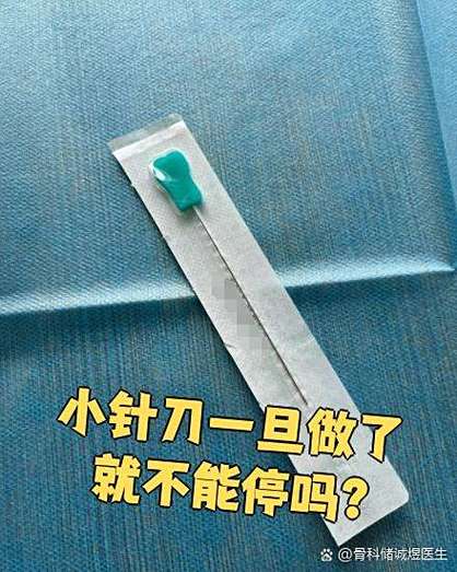 小针刀一旦做了就不能停吗