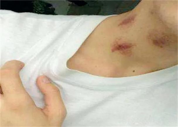 大人知道草莓印吗